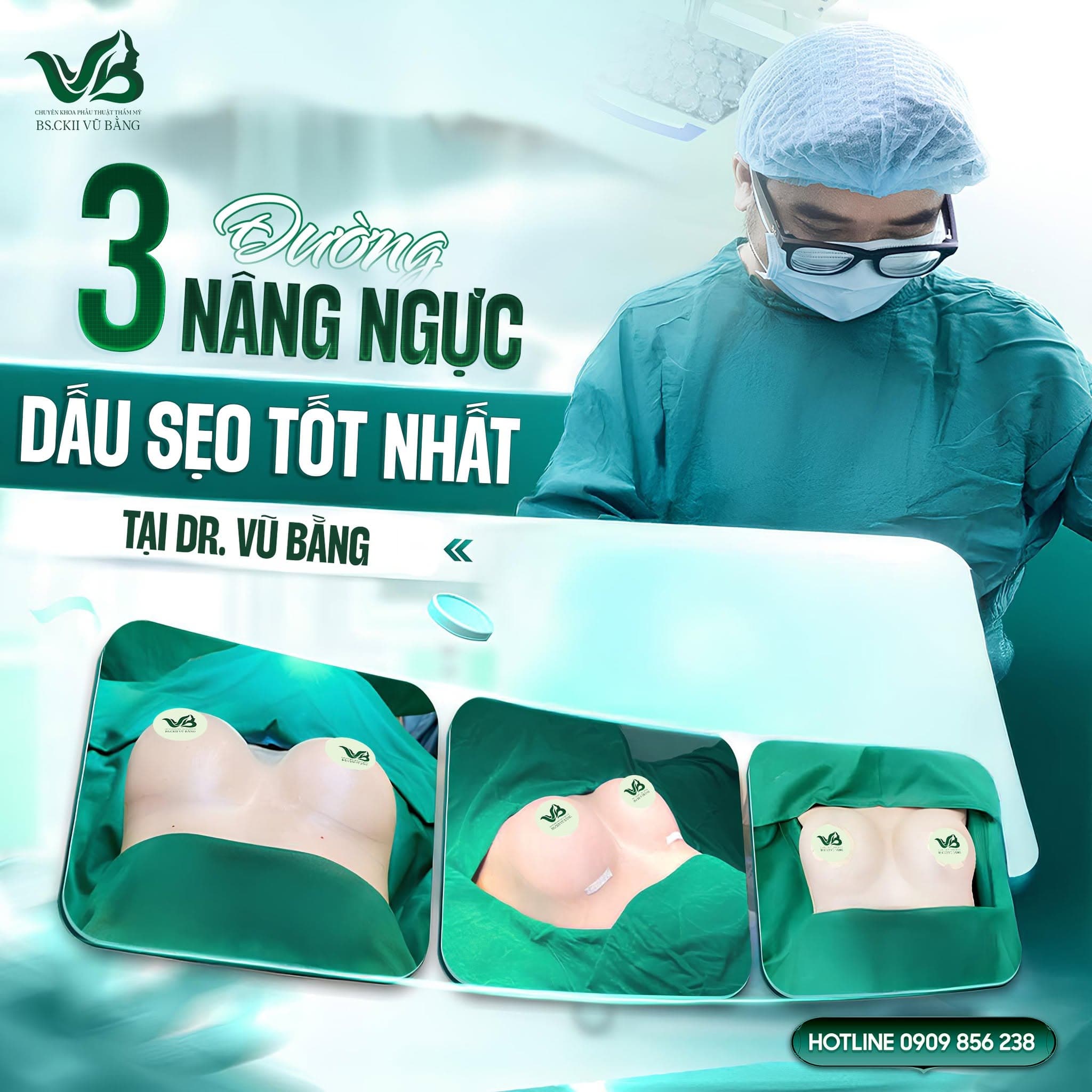 Nâng ngực